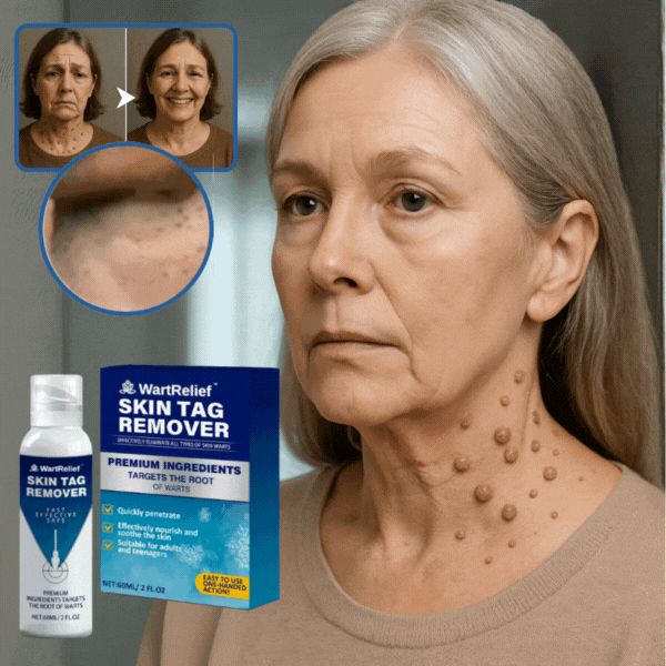 Meloriana™ Crème anti-verrues | Une peau lisse et sans verrues pour toujours  - dans 4 jours !